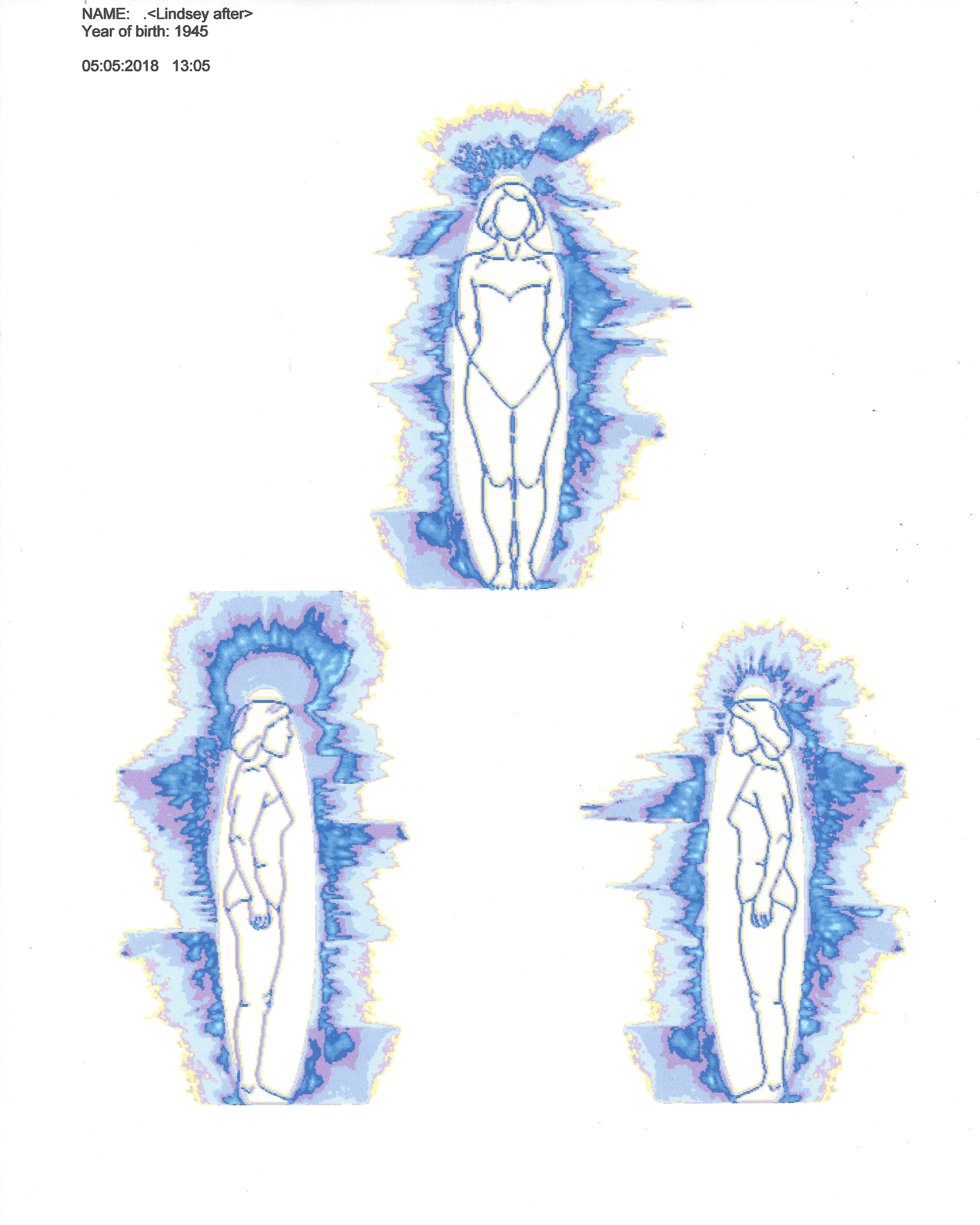 Lindsay GDV After self healing_1305